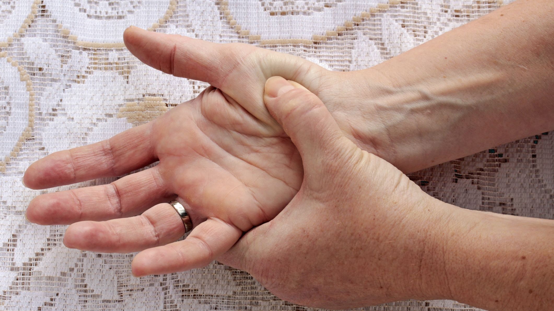 Flourishing Rheumatoid Arthritis Hand Surgeon Houston