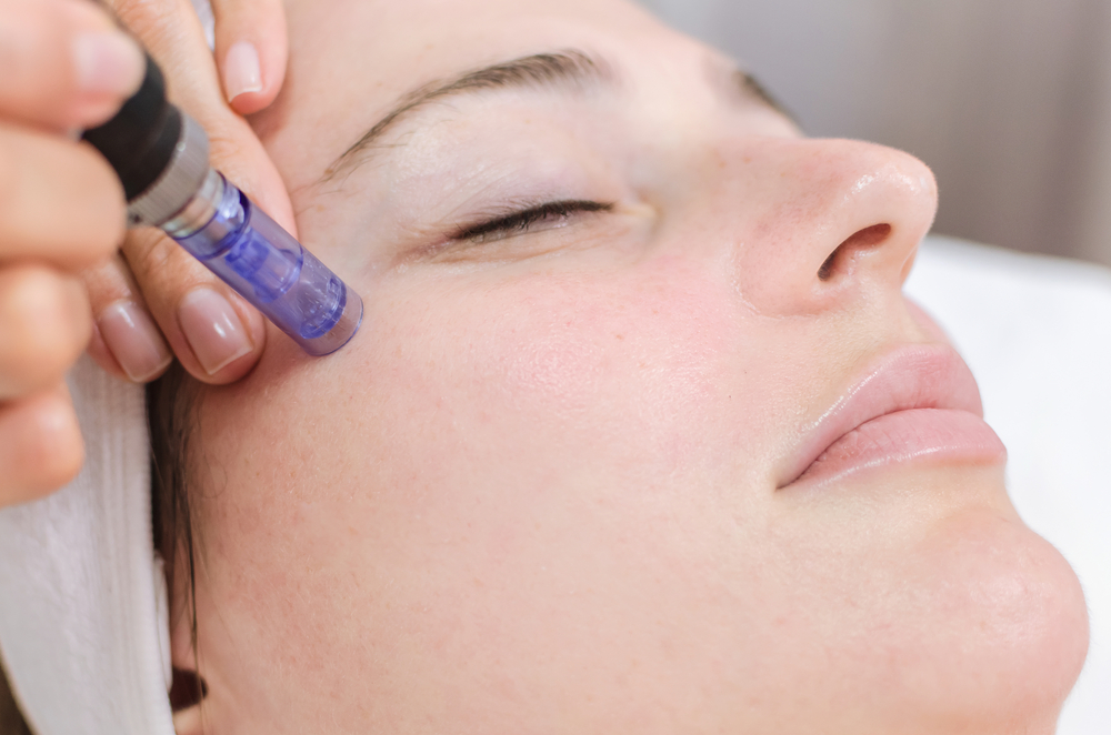Looking for best microneedling service at your place